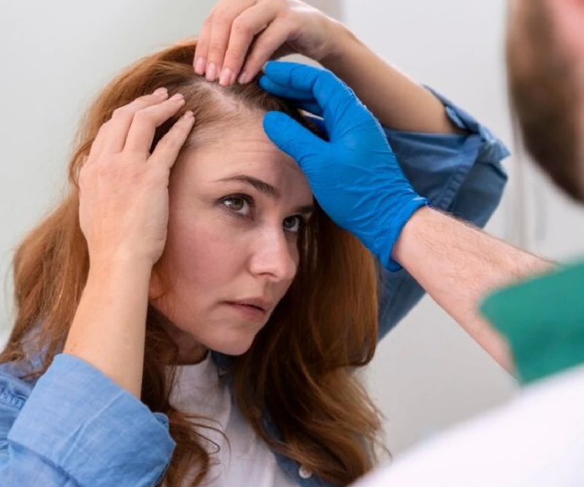 Hair Loss Treatment