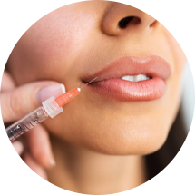 Lip fillers