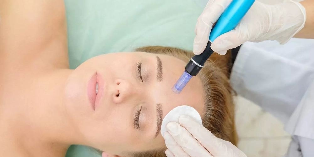 Microneedling