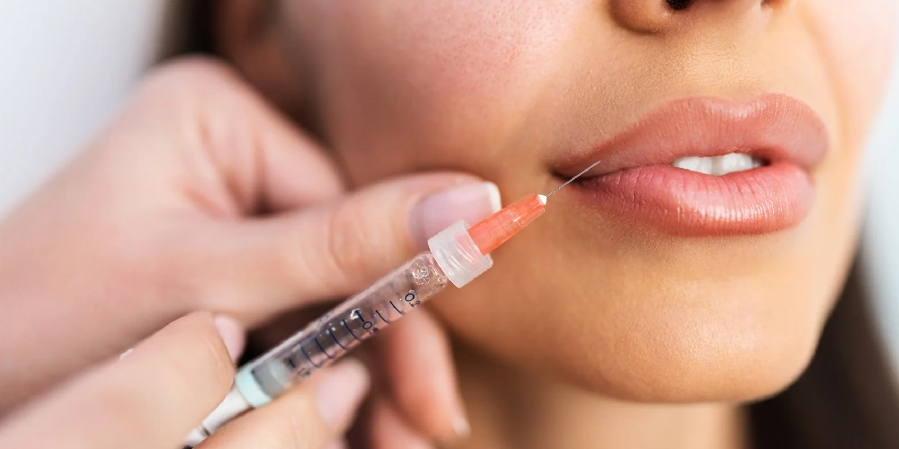 lip fillers 3 Lip Fillers