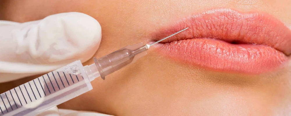 lip fillers 4 Lip Fillers