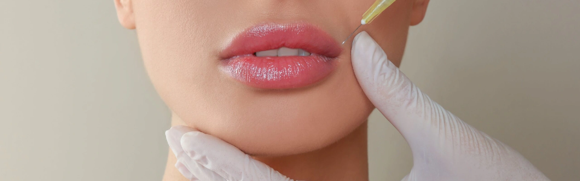 lip fillers